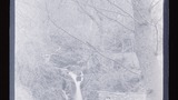 Rydal, Lower Falls