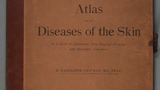 Atlas of the diseases of the skin : in a series of illustrations from original drawings with descriptive letterpress (v.4)