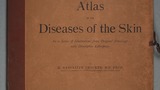 Atlas of the diseases of the skin : in a series of illustrations from original drawings with descriptive letterpress (v.5)