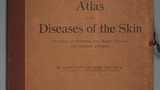Atlas of the diseases of the skin : in a series of illustrations from original drawings with descriptive letterpress (v.5)