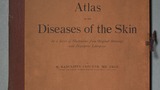 Atlas of the diseases of the skin : in a series of illustrations from original drawings with descriptive letterpress (v.7)