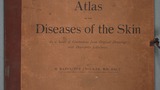 Atlas of the diseases of the skin : in a series of illustrations from original drawings with descriptive letterpress (v.1)