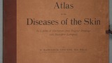 Atlas of the diseases of the skin : in a series of illustrations from original drawings with descriptive letterpress (v.2)