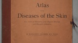 Atlas of the diseases of the skin : in a series of illustrations from original drawings with descriptive letterpress (v.3)